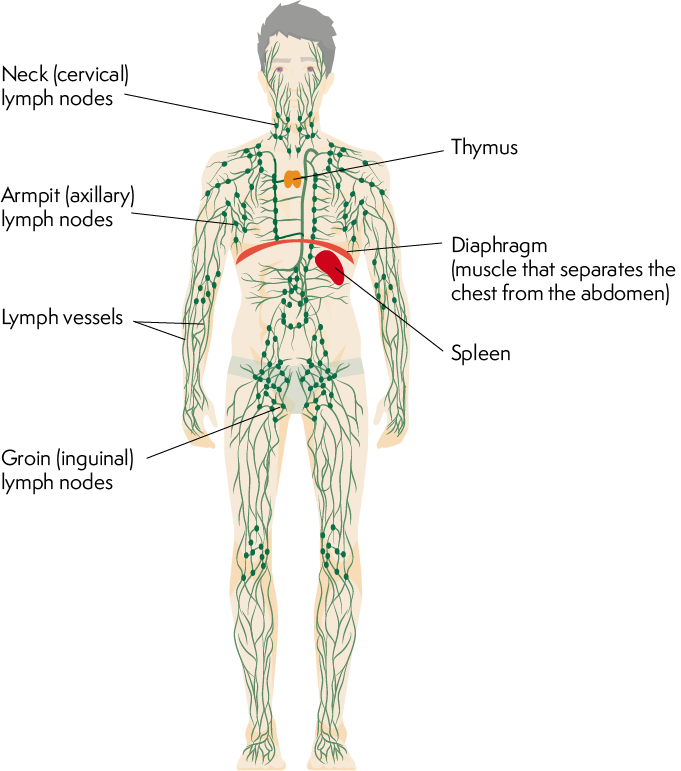 Splenic Lymphoma SL Lymphoma Australia   Lymphatic System 